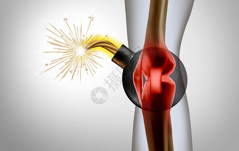 疼痛的膝盖和的关节,作为医学上的例证,表明一个人的骨骼显示,身体受伤或事故是带有3D插图元素的身体损伤定时。图片