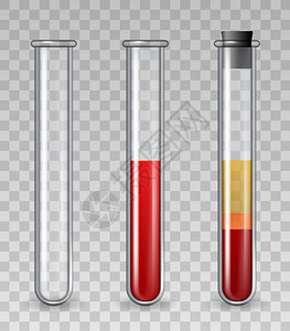 带血液的试验管现实玻璃医疗管装满红色细胞血浆丰富的小板PRP皮肤治疗矢量组说明药理学和治疗科化的试验管有血液的试验管现实玻璃医疗图片