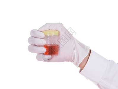医生手持套透明容器分析白色背景的血迹尿液高清图片