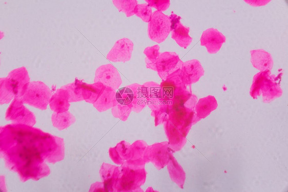 显微镜下的多孔相上白色背景上的粉红点摘要图片