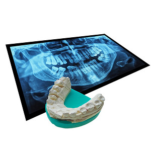 人体牙齿的医学X光成像和阳牙科造模的正复制成像这些由对白上孤立的牙齿负面印象而成背景图片