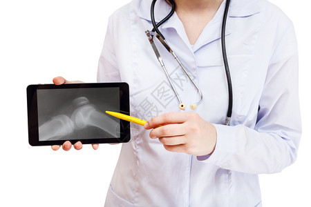 在平板电脑上的护士点在白色背景隔离的屏幕上用X光照片拍摄人的膝关节图片