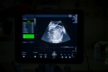 4D图象的超声波医疗机在LABOR和医院产房图片