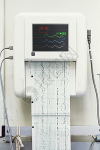 在医院的分娩室和产房关闭胎儿监视器或无压力测试打印婴儿心跳电图和母子宫收缩图片
