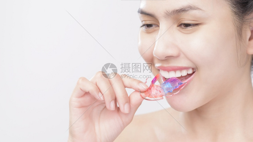 特写美丽的牙齿女人用牙套戴牙套的美女牙齿特写