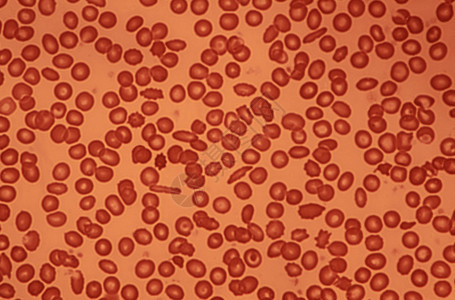 血液医学用显微镜照相的人体血细胞艾伦一种图片
