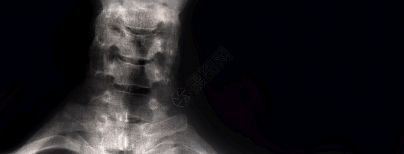中年人骨骼疼身体X光颈部医疗概念全景模拟小样药物设计图片