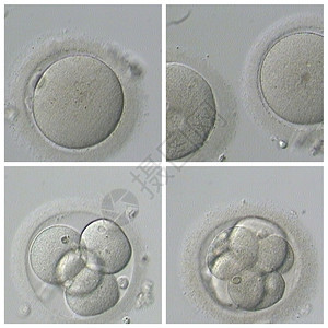 显微镜医疗的人类体外受精基因图片