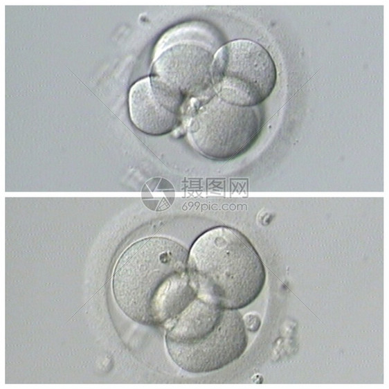 生殖基因育力人类体外受精图片