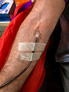 专业知识接收捐赠者献血输时的者在医院接受液的商人右臂特写医疗保健和慈善机构也是世界献血者日的概念图像背景6月14日图片