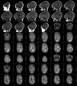 解剖学病人医疗的MRI人体头部扫描图片