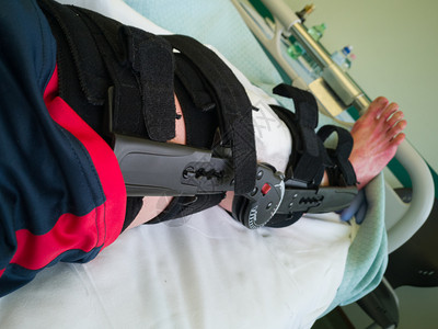 康复在医院的床上进行前交叉韧带手术后补丁和矫形支架的人腿在医院床上进行前交叉韧带手术后补丁和矫形支架的人腿帮助运动员图片