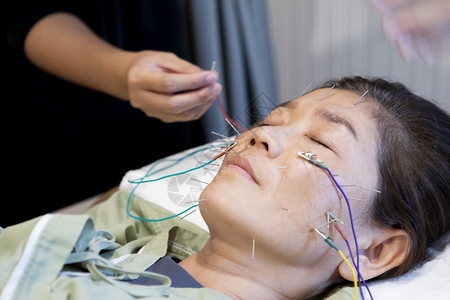 电的人医疗正在接受针缝刺美容的亚洲女面临电动针头治疗图片