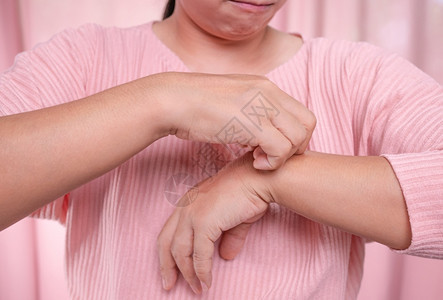 恼人的令憎恶中年妇女从皮肤痒干肝炎皮过敏血吸虫病和皮肤疾等导致的手部抓痒细菌反应图片