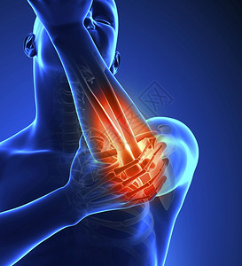 解剖学红色的3d肘部疼痛蓝色颜健康图片