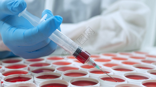 样品血液圆圈男人手的特写蓝色套拿着注射器从白色表面上的一组圆形红色临床样本中抽取红色液体样本圆形红色临床样本图片