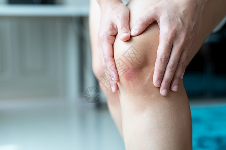 痛撕裂Asiia妇女膝盖受青伤有选择地集中瘀伤图片