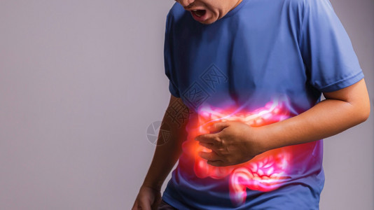 小肠结炎息肉烦躁IBSX射线概念图片