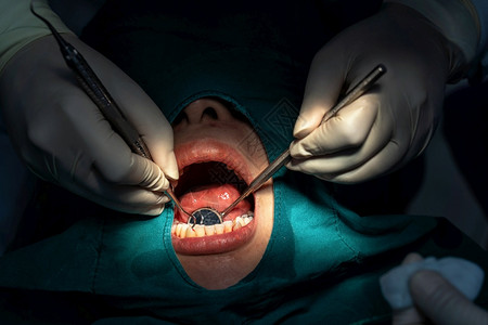 在牙科诊所进行手术治疗的病人背景图片