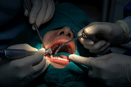 在牙科诊所做牙齿手术的病人背景图片
