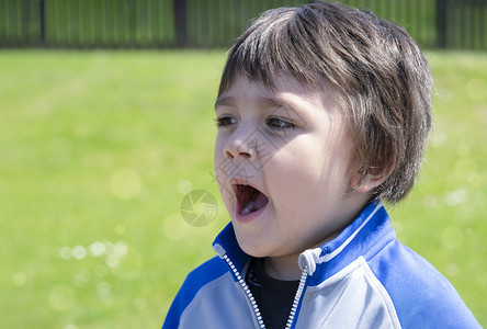 得到外部季节儿童在春或夏外出玩时过敏Kid有灰泥的反射或干热孩子过敏等症状儿童过敏和Kid有抗体反应或干热图片