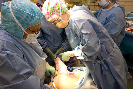 C  节手术妇科医生皮肤护士团队操作外科怀孕妇科剖腹产图片