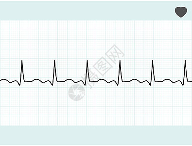 普通心电图ECG EPS 8图片