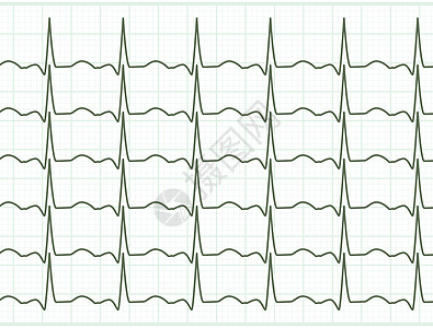 EPS 8心脏心血管病医院药品疾病诊断插图脉动收藏心电图监控痕迹设计图片