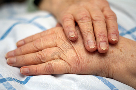 手有皱纹拇指养老院护理老年老年人手指医学退休图片