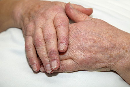旧的皱纹手退休养老院拇指老年老年人手指医学护理图片