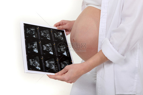 孕妇在看她的扫描图片