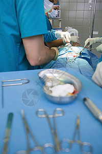 一组外科医生在手术车旁边工作图片