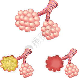 Alveoli 集成阿尔维奥利图片