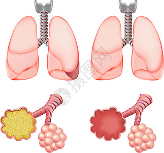 Alveoli 肺套件图片