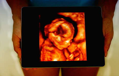 持有平板石片的妇女概念 超声波的婴儿形象图片