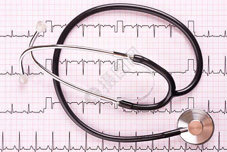 心动成像的立体镜语音图表诊断药品心脏病学白色心电图内窥镜测量乐器背景图片