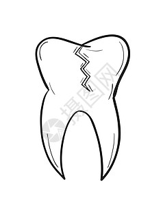 牙齿有缺陷的粗牙草图图片