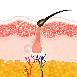 摘除头发理发乳突插图休息表皮黑色素生长毛细管美丽脱毛损失图片