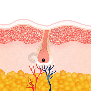 摘除头发理发美丽生长真皮脱毛损失插图乳突化期毛细管皮肤科图片