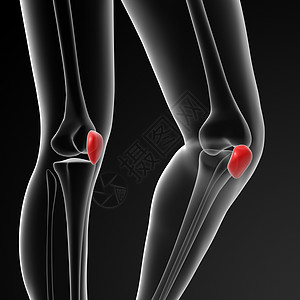 倾角关节膝盖大腿药品胫骨访问软骨控制症状肌腱图片
