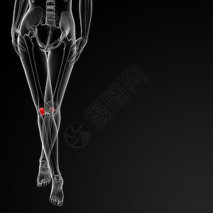 骨板骨蓝色症状外科x光手术控制解剖学大腿膝盖胫骨图片