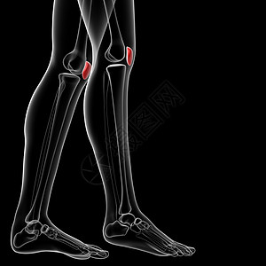 骨板骨x光膝盖肌腱伤害蓝色症状股骨列表大腿访问图片