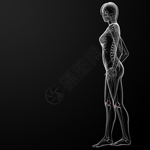 骨板骨控制韧带膝盖药品运动手术髌骨股骨腓骨解剖学图片