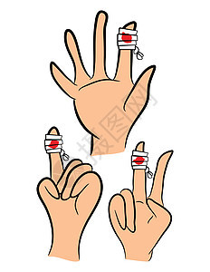 一组受伤的指头 用红色血浆包在绷带中 白本上隔绝了矢量插图图片