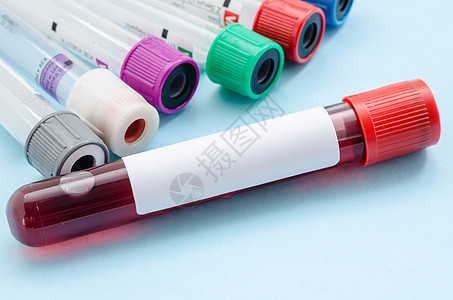 用于筛选测试的血样输血管背景