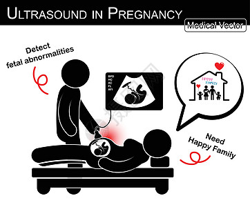 医生通过超声检查孕妇和胎儿在子宫内的生长情况 妇女考虑未来幸福的家庭 医学 科学和保健概念 黑白 平面设计图片