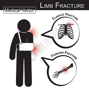 贴着手臂的人 锁骨和前臂骨折 和文本气泡 医疗 健康 医疗保健矢量图片