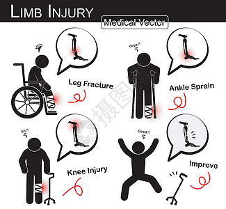 一组肢体损伤 带轮椅的棍子人 腋窝拐杖 三脚架拐杖 胫骨和腓骨骨折 脚踝扭伤 膝关节痛 矢量医疗棍子人 物理治疗概念图片