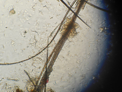 一只显微镜 猫的毛发被损伤过皮质脱氧植物动物园霉菌病真皮传染疾病挑衅损害表皮真菌诊断图片