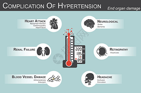 高血压的并发症 心脏病发作 心肌梗塞 心肌病 脑 中风 痴呆 视力丧失 头痛 肾功能衰竭 动脉粥样硬化 动脉瘤 终末器官损伤图片